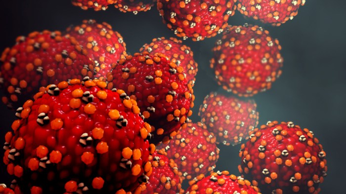 A case of measles has been confirmed in a young child from Suffolk County.