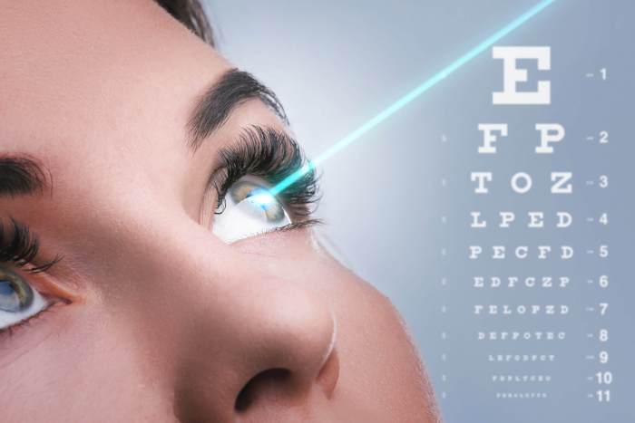 Laser Eye Surgery