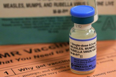 Measles_A