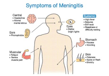 meningitis