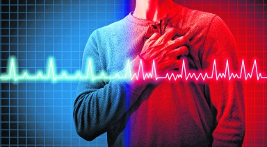 If left untreated, Afib can lead to stroke, heart failure and premature cardiac death. But fortunately, Afib is treatable and, in some cases, preventable. 